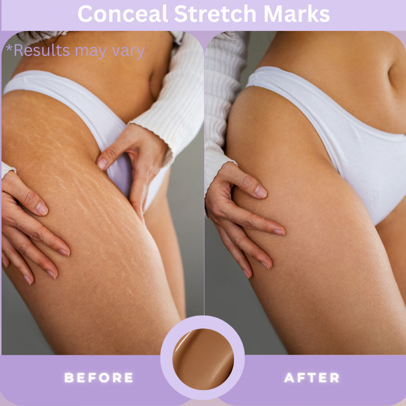 💥LOVILDS™ Body Concealer,Body Coverage Perfector – Waterproof & Sweatproof Leg & Body Makeup, Concealer & Tattoo Cover-Up