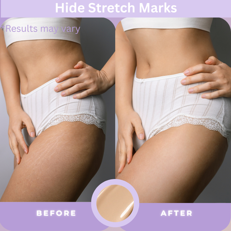 💥LOVILDS™ Body Concealer,Body Coverage Perfector – Waterproof & Sweatproof Leg & Body Makeup, Concealer & Tattoo Cover-Up