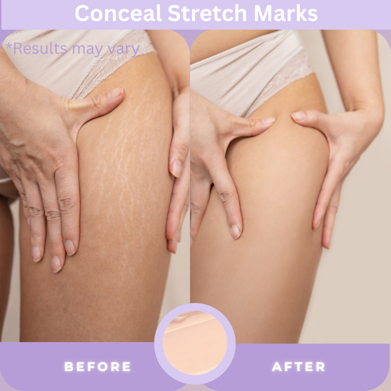 💥LOVILDS™ Body Concealer,Body Coverage Perfector – Waterproof & Sweatproof Leg & Body Makeup, Concealer & Tattoo Cover-Up