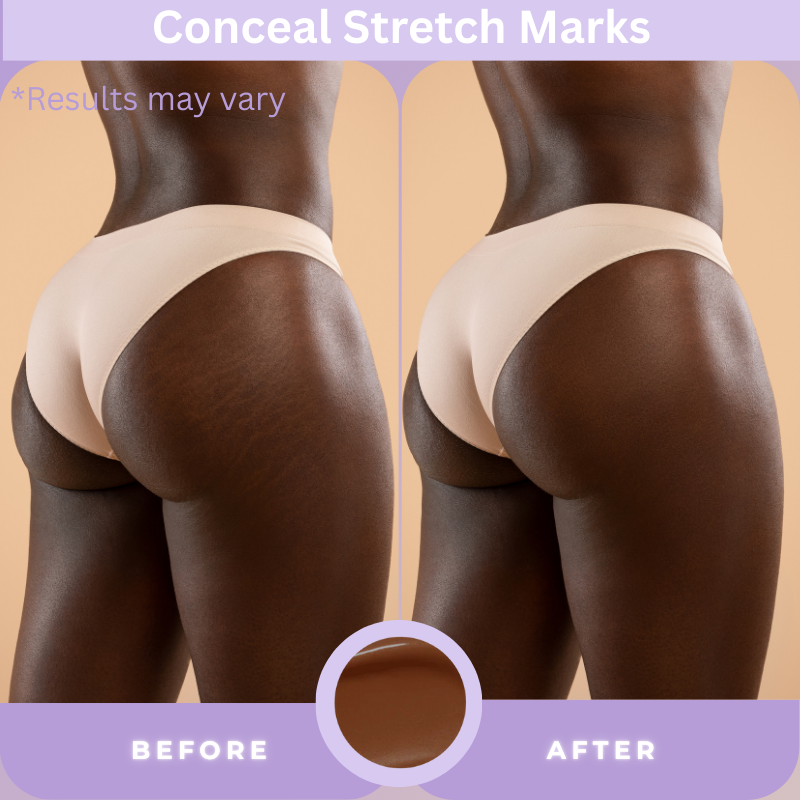 💥LOVILDS™ Body Concealer,Body Coverage Perfector – Waterproof & Sweatproof Leg & Body Makeup, Concealer & Tattoo Cover-Up