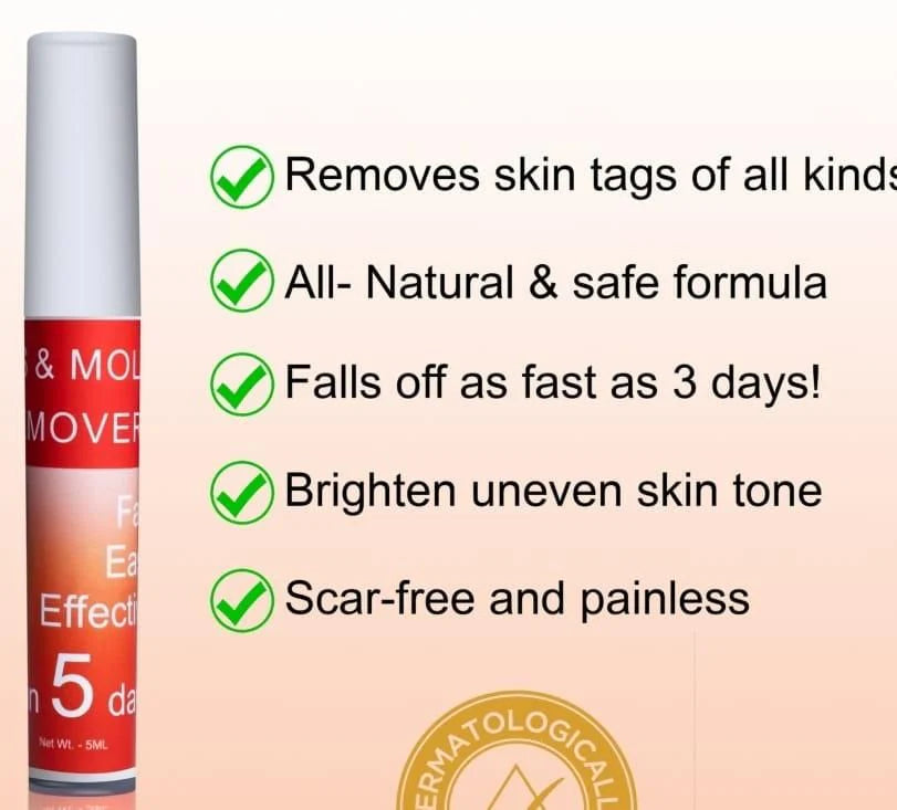 LOVILDS™ Tags & Moles Remover (Buy 1 Get 1 Free🔥🔥)