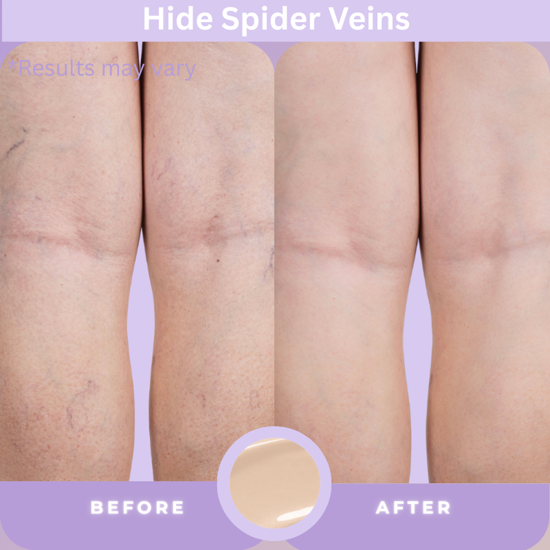 💥LOVILDS™ Body Concealer,Body Coverage Perfector – Waterproof & Sweatproof Leg & Body Makeup, Concealer & Tattoo Cover-Up
